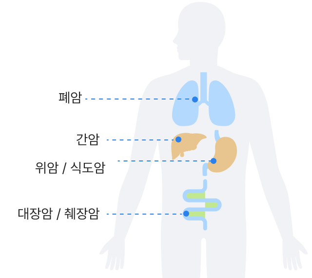 폐암, 간암, 위암/식도암, 대장암/췌장암 신체 이미지