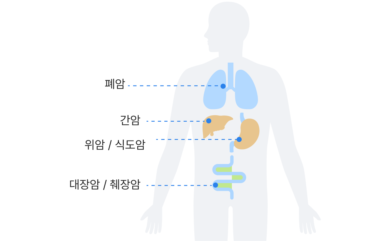 폐암, 간암, 위암/식도암, 대장암/췌장암 신체 이미지